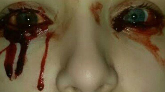 El extraño caso de la niña que llora sangre-0
